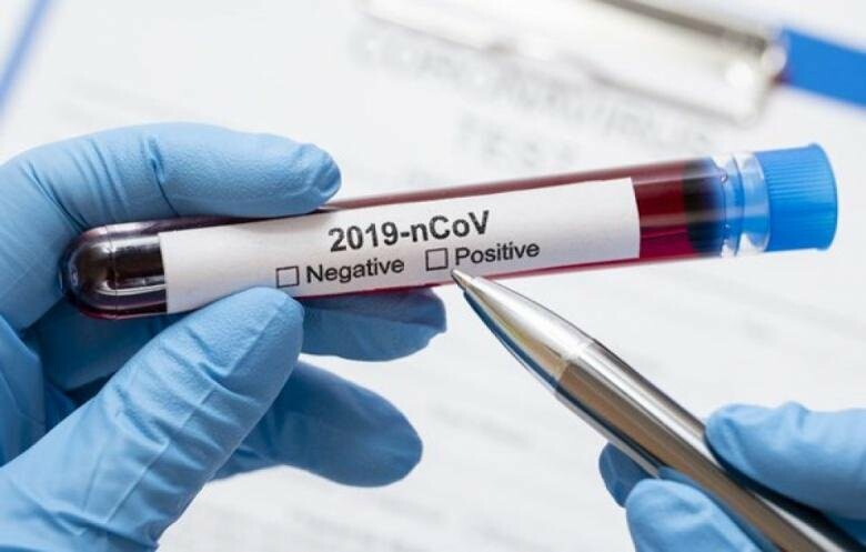 Показник госпіталізацій через COVID-19 на Черкащині – один із найвищих в Україні
