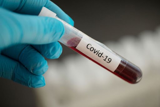 За добу 163 випадки коронавірусу в області