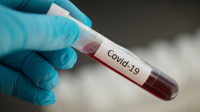 400 нових випадків коронавірусу на Черкащині