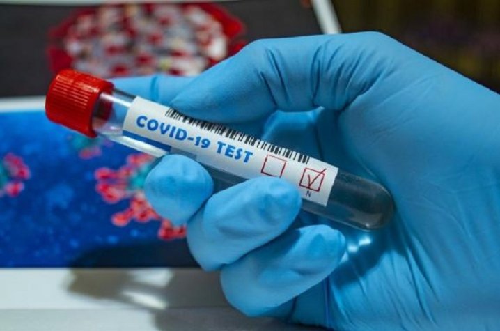 878 випадків інфікування за добу:коронавірус на Черкащині