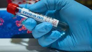681 випадок коронавірусу виявили за добу на Черкащині