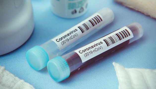 Виявили 379 випадків коронавірусу за добу на Черкащині