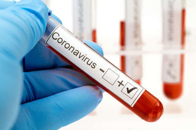 Медики діагностували понад тисячу випадків коронавірусу на Черкащині